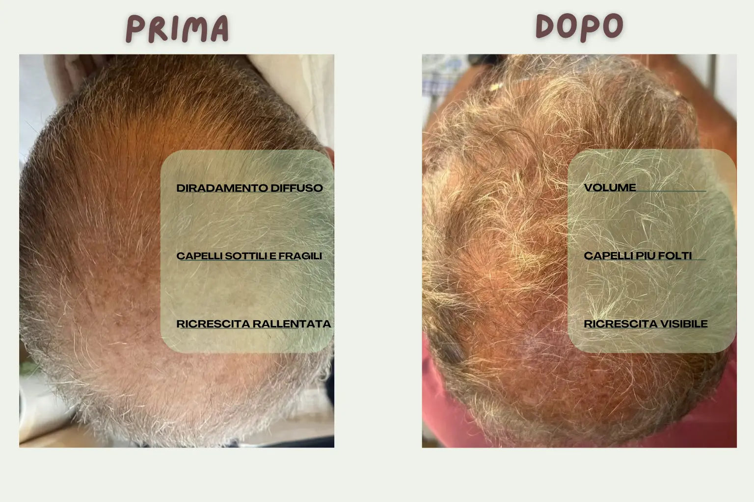 Olio Rinforzante Anticaduta - Trattamento Naturale per la Ricrescita